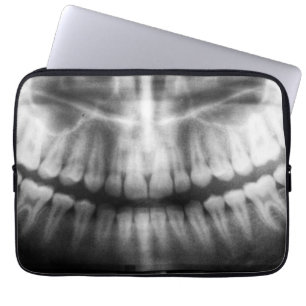 X-Ray Teeth Mouth Smile Black en White Laptop Sleeve