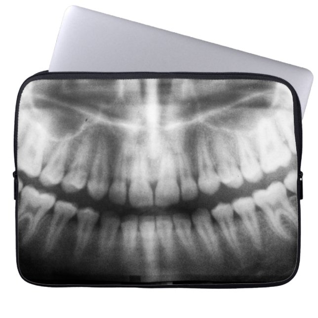 X-Ray Teeth Mouth Smile Black en White Laptop Sleeve (Voorkant)
