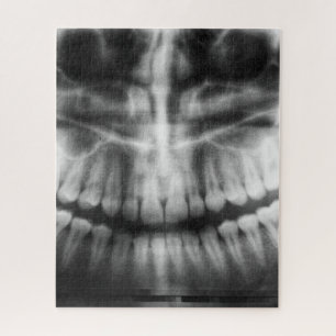X-Ray Teeth Mouth Smile Black en White Legpuzzel