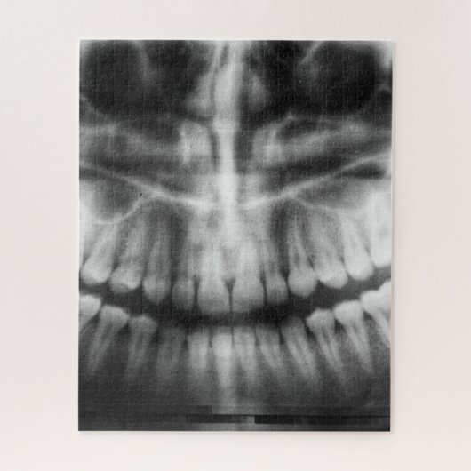 X-Ray Teeth Mouth Smile Black en White Legpuzzel (Verticaal)