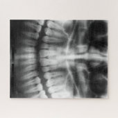 X-Ray Teeth Mouth Smile Black en White Legpuzzel (Horizontaal)