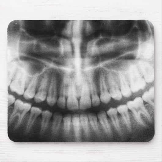 X-Ray Teeth Mouth Smile Black en White Muismat (Voorkant)