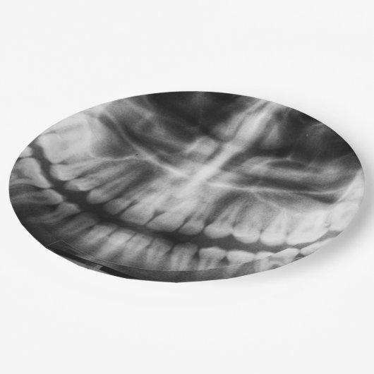 X-Ray Teeth Mouth Smile Black en White Papieren Bordje (Gekanteld)