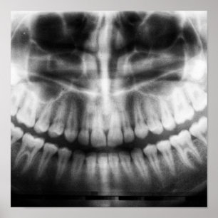 X-Ray Teeth Mouth Smile Black en White Poster