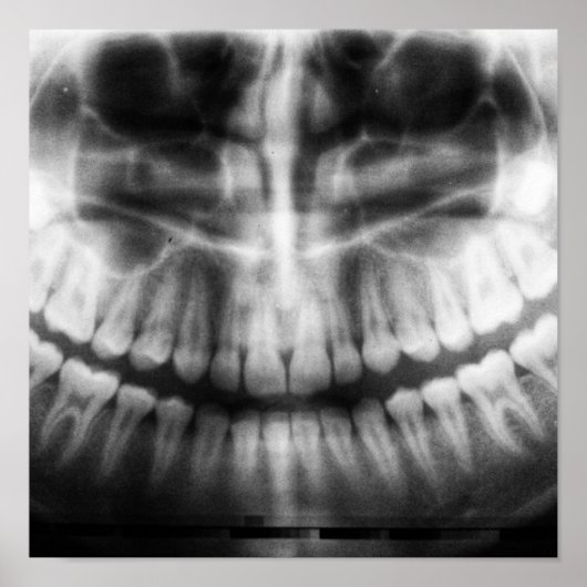 X-Ray Teeth Mouth Smile Black en White Poster (Voorkant)