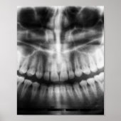X-Ray Teeth Mouth Smile Black en White Poster (Voorkant)
