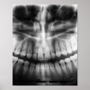 X-Ray Teeth Mouth Smile Black en White Poster
