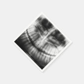 X-Ray Teeth Mouth Smile Black en White Servet (Hoek)