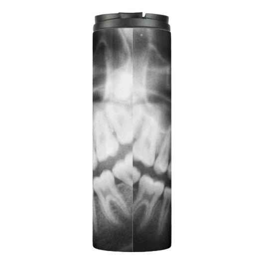 X-Ray Teeth Mouth Smile Black en White Thermosbeker (Achterkant)
