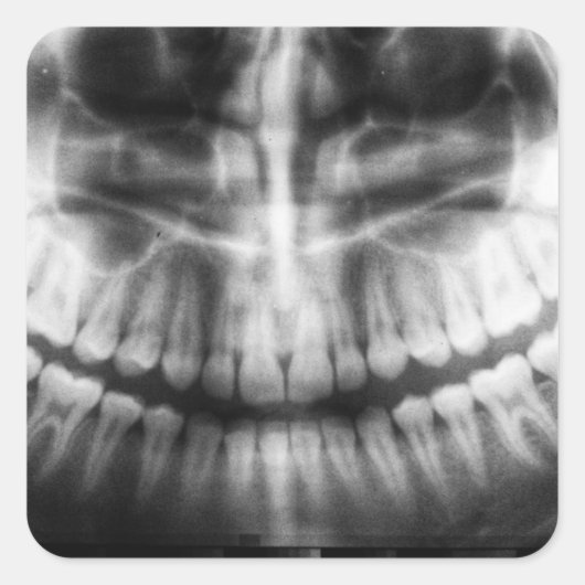 X-Ray Teeth Mouth Smile Black en White Vierkante Sticker (Voorkant)