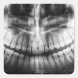 X-Ray Teeth Mouth Smile Black en White Vierkante Sticker