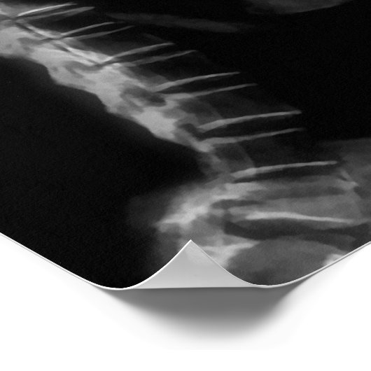 X-RAY VISION SKELETON SINGON OP RETRO MIC - B&W POSTER (Hoek)