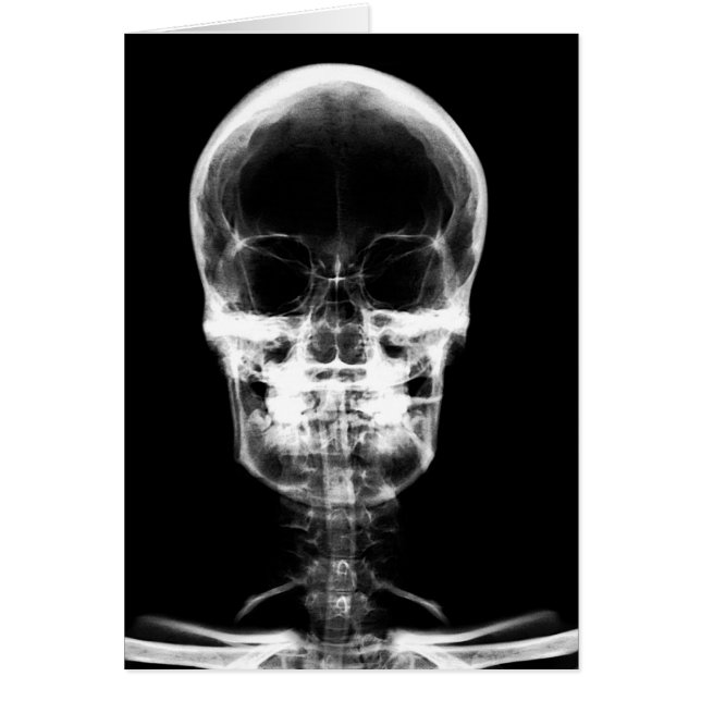 X-RAY VISION SKELETON SKULL - B&W (Voorkant)
