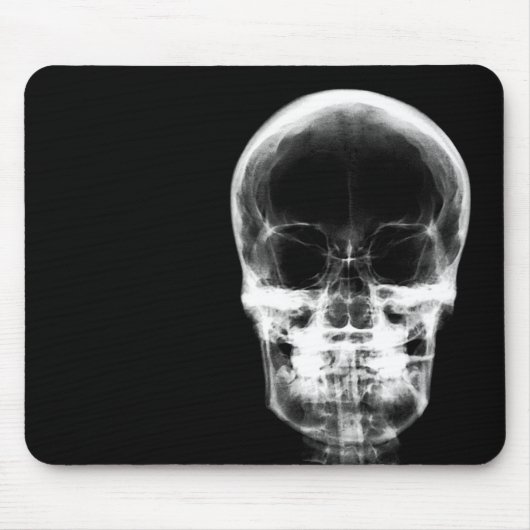 X-RAY VISION SKELETON SKULL - B&W MUISMAT (Voorkant)
