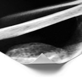 X-RAY VISION SKELETON SKULL - B&W POSTER (Hoek)