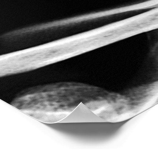 X-RAY VISION SKELETON SKULL - B&W POSTER (Hoek)