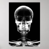 X-RAY VISION SKELETON SKULL - B&W POSTER (Voorkant)
