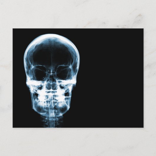 X-RAY VISION SKELETON SKULL - BLUE BRIEFKAART (Voorkant)