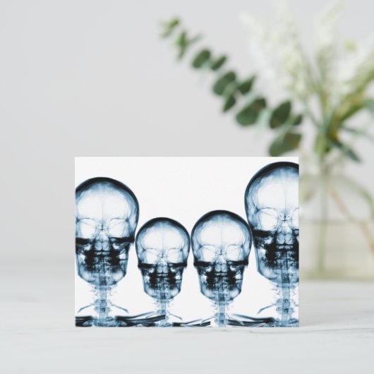 X-Ray Vision Skeleton Skull - Blue Briefkaart (Staand voorkant)