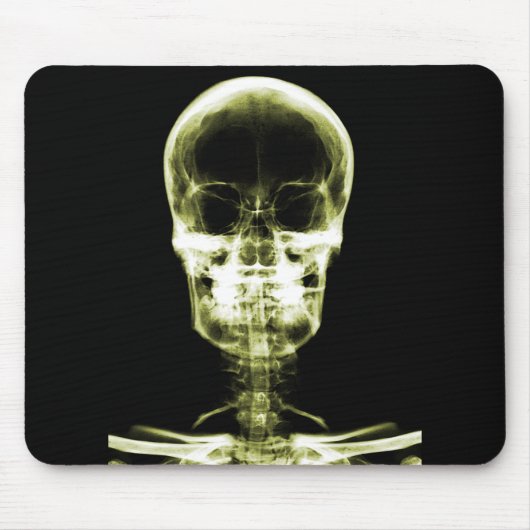 X-RAY VISION SKELETON SKULL - GEEL MUISMAT (Voorkant)