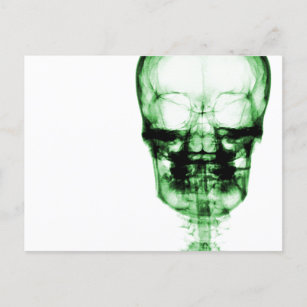 X-Ray Vision Skeleton Skull - Green Briefkaart