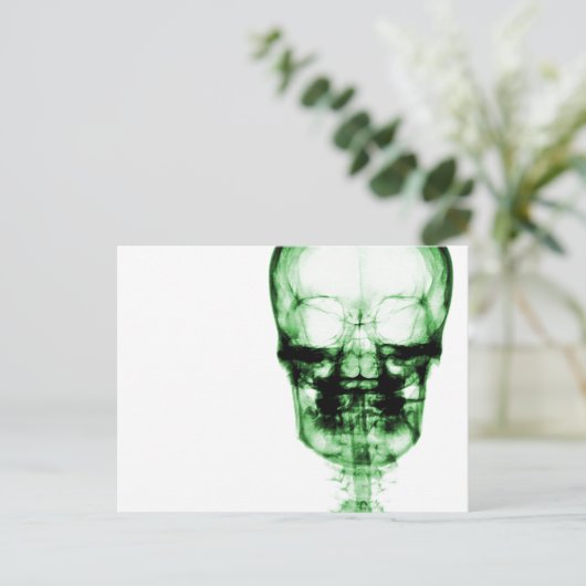 X-Ray Vision Skeleton Skull - Green Briefkaart (Staand voorkant)