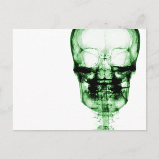 X-Ray Vision Skeleton Skull - Green Briefkaart (Voorkant)