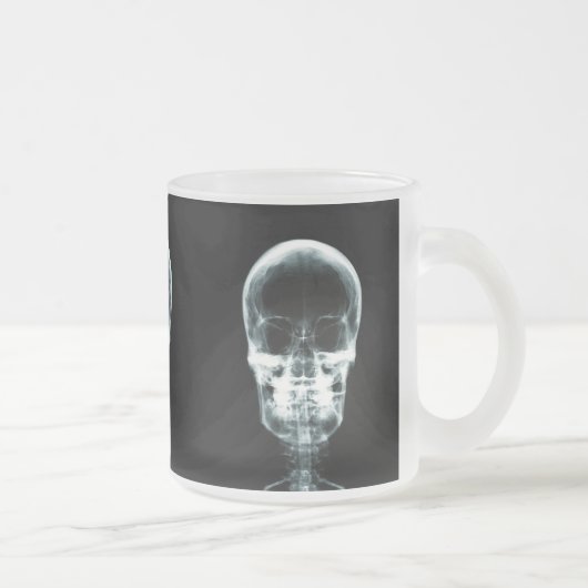 X-RAY VISION SKELETON SKULL - ORIGINEEL MATGLAS KOFFIEMOK (Rechts)