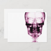 X-Ray Vision Skeleton Skull - Pink Briefkaart (Voorkant / Achterkant)