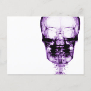 X-Ray Vision Skeleton Skull - Purple Briefkaart
