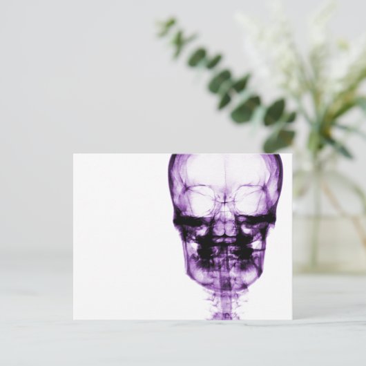 X-Ray Vision Skeleton Skull - Purple Briefkaart (Staand voorkant)