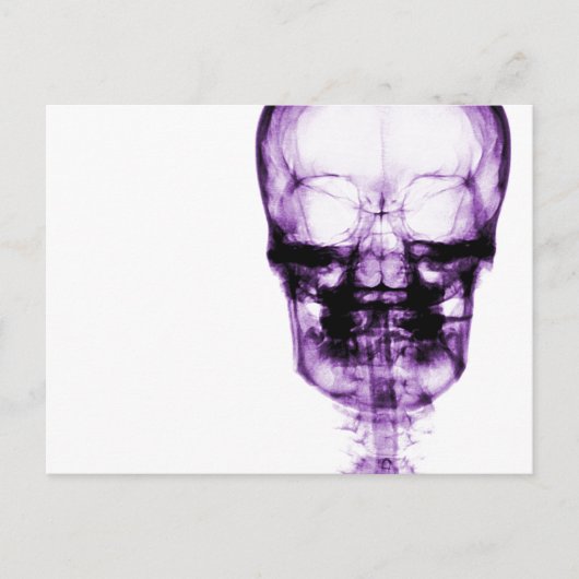 X-Ray Vision Skeleton Skull - Purple Briefkaart (Voorkant)