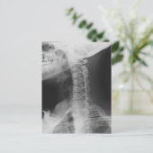 X-rayed 2 briefkaart (Staand voorkant)