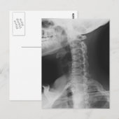 X-rayed 2 briefkaart (Voorkant / Achterkant)