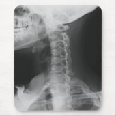 X-rayed 2 muismat (Voorkant)