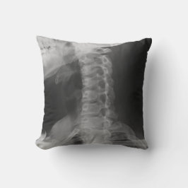 X-Rayed 2 (origineel) Kussen