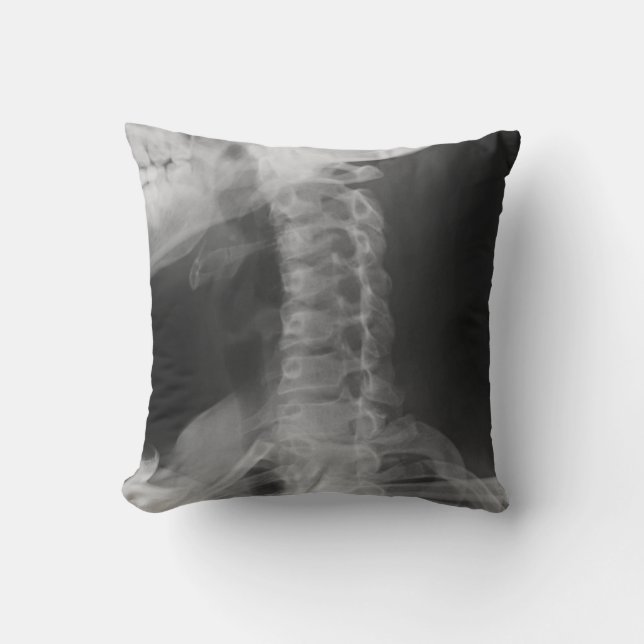 X-Rayed 2 (origineel) Kussen (Voorkant)