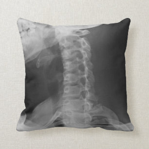 X-Rayed 2 (origineel) Kussen