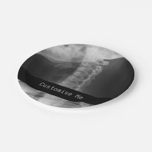 X-Rayed 2 (origineel) Papieren Bordje (Gekanteld)