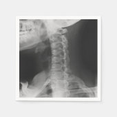X-Rayed 2 (origineel) Servetten (Voorkant)