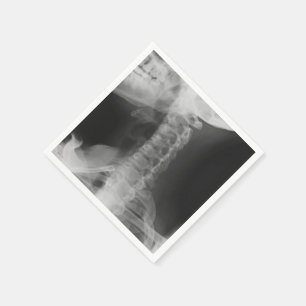 X-Rayed 2 (origineel) Servetten