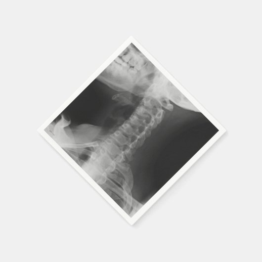 X-Rayed 2 (origineel) Servetten (Hoek)