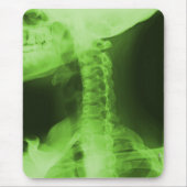 X-rayed 2 - Radioactive Green Muismat (Voorkant)
