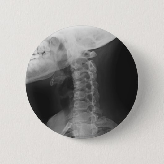 X-rayed 2 ronde button 5,7 cm (Voorkant)