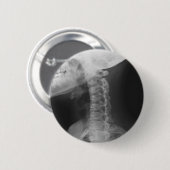 X-rayed 2 ronde button 5,7 cm (Voorkant /achterkant)