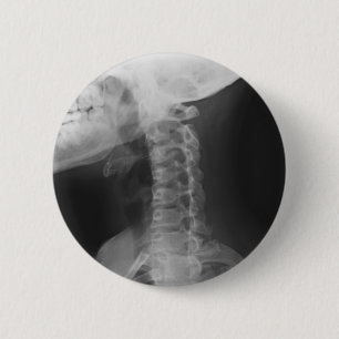 X-rayed 2 ronde button 5,7 cm