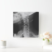 X-rayed 2 vierkante klok (Huis)