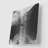 X-rayed 2 vierkante klok (Hoek)