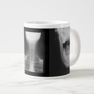X-rayed 3 grote koffiekop