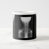X-rayed 3 grote koffiekop (Voorkant)